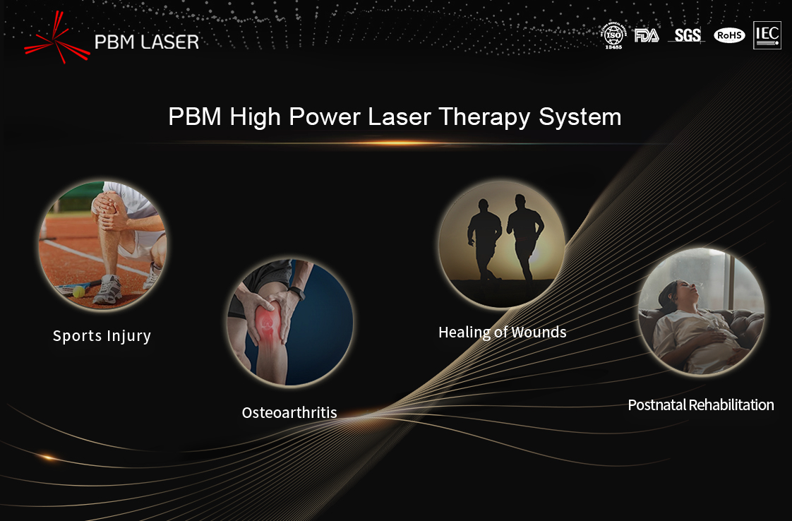 Mga Prinsipyo at Pag-aaral ng Kaso ng Rehabilitasyon ng Ehersisyo na may High Energy Laser ng PBM Medical Laser - Taunang Ulat sa Highlight ng Pagpupulong ng Rehabilitation Medicine