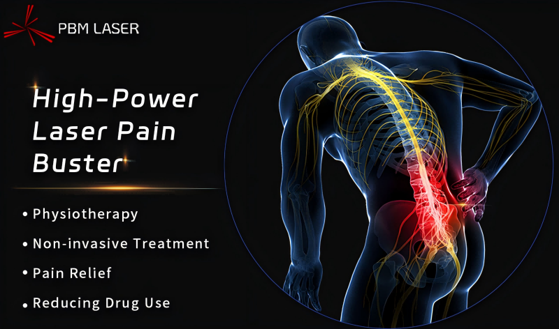 PBM Medical Laser 丨 Pag-unlock sa Rehabilitation Code, Nakatanggap ang High-Power Laser ng Grade A na Rekomendasyon sa Talamak na Low Back Pain Diagnosis at Mga Alituntunin sa Paggamot (2024 Edition)